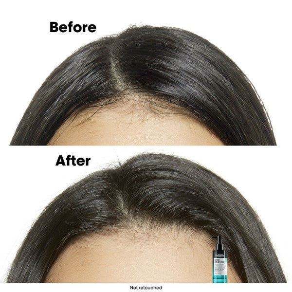 L'Oreal Serie Expert Scalp Advanced Anti-Oiliness Serum 90ml