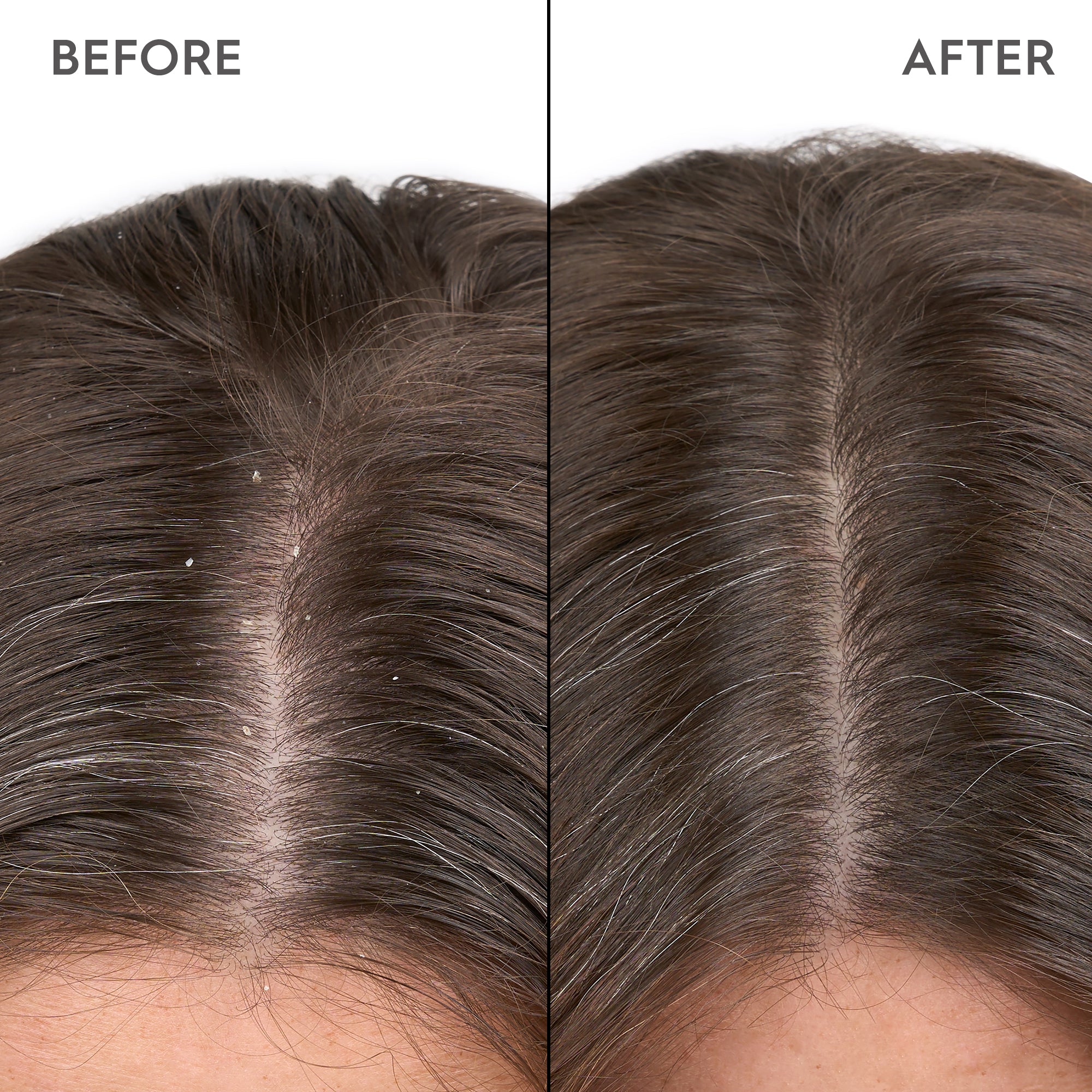 Kerasilk Specialist Anti-Dandruff Scalp Serum 100ml