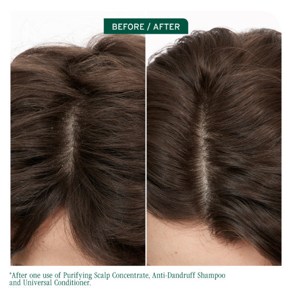 Matrix Biolage Scalp Sync Anti Dandruff Shampoo 400ml *NEW*