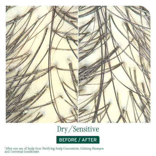 Matrix Biolage Scalp Sync Calming Shampoo 400ml *NEW*