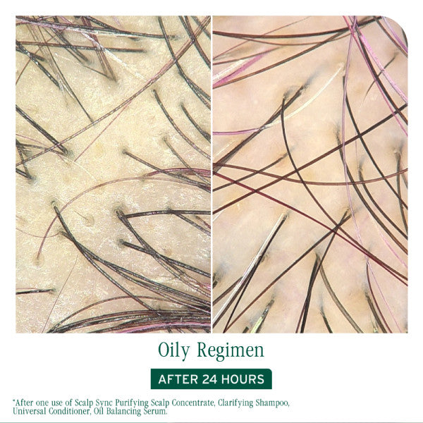 Matrix Biolage Scalp Sync Oil Balancing Serum 50ml *NEW*