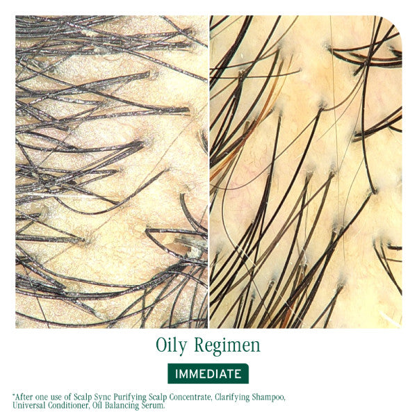 Matrix Biolage Scalp Sync Purifying Scalp Concentrate 200ml *NEW*