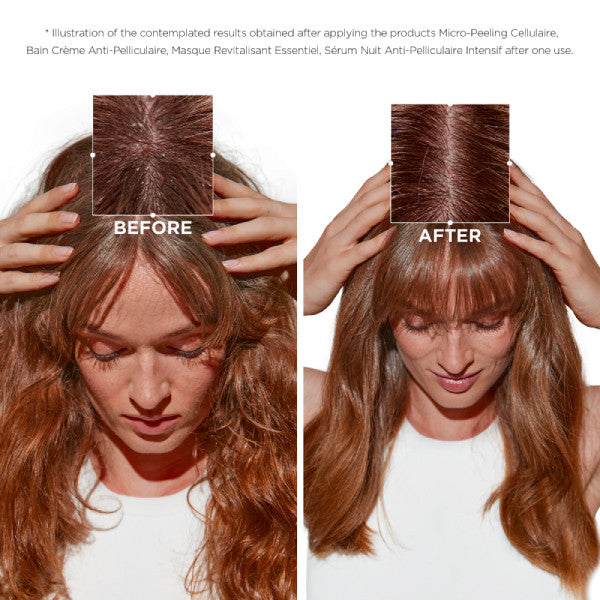 Kerastase Symbiose Micro-Peeling Cellular Scalp Scrub 200ml for Dandruff Flakes