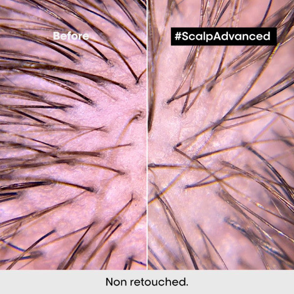 L'Oreal Scalp Advanced Anti-Discomfort Dermo-Regulator Shampoo 300ml