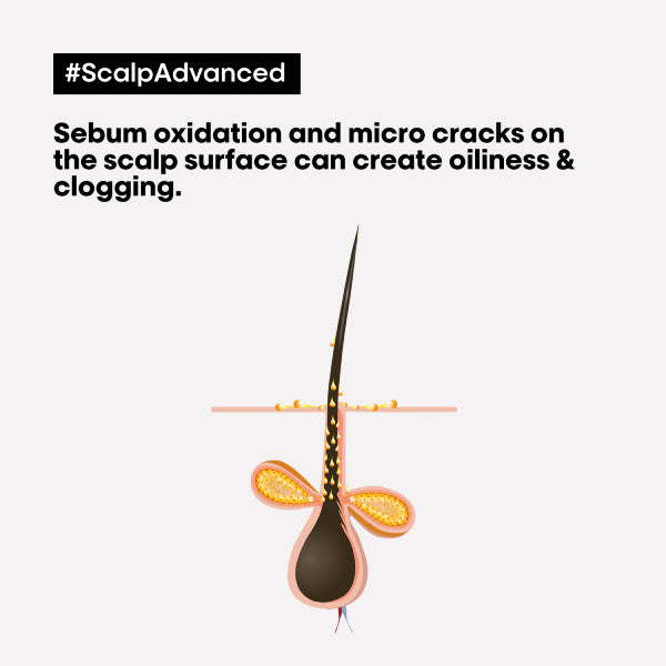 L'Oreal Scalp Advanced Anti-Oiliness 2in1 Deep Purifier Clay 250ml