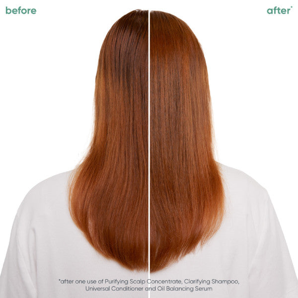 Matrix Biolage Scalp Sync Oil Balancing Serum 50ml