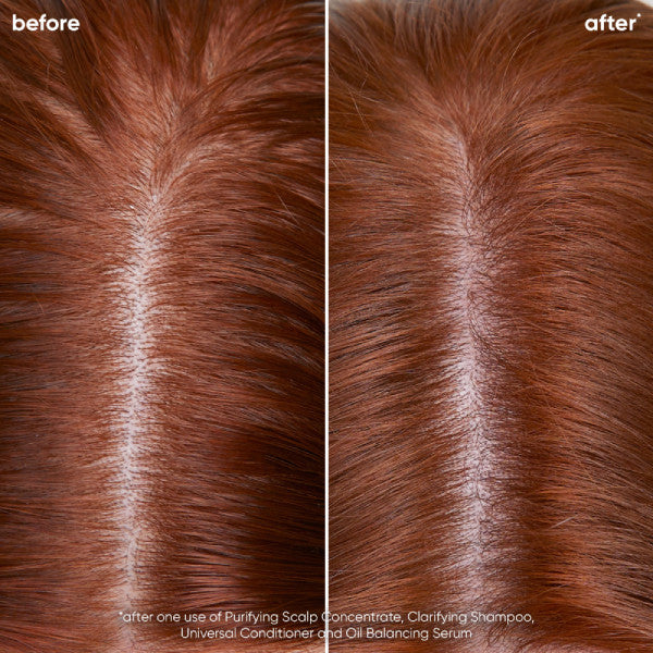 Matrix Biolage Scalp Sync Oil Balancing Serum 50ml