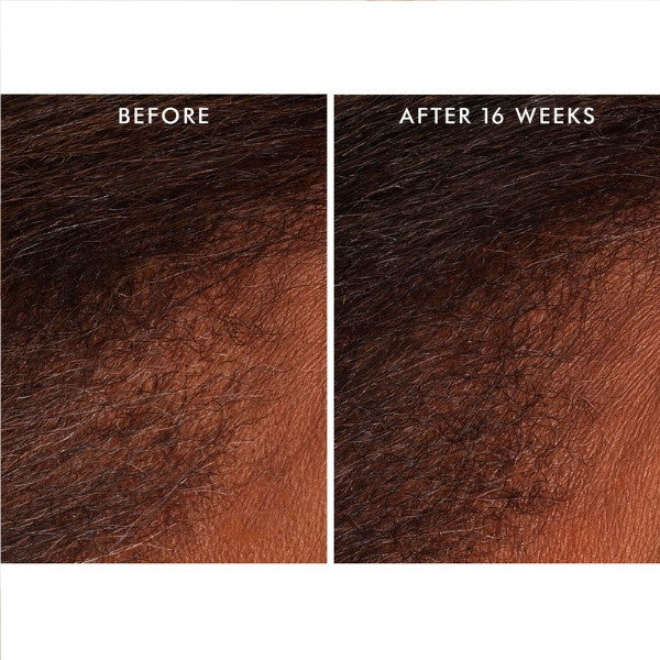 Moroccanoil Scalp Revitalizing Scalp Tonic 100ml