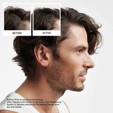 Nioxin System 2 Shampoo 300ml - For Natural Hair with Progressed Thinning