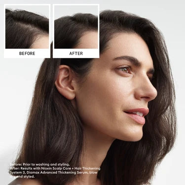 Nioxin System 3 Trial Kit - For Coloured Hair with Light Thinning
