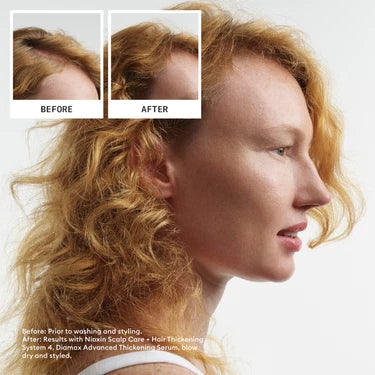 Nioxin System 4 Shampoo 1L - For Coloured Hair with Progressed Thinning
