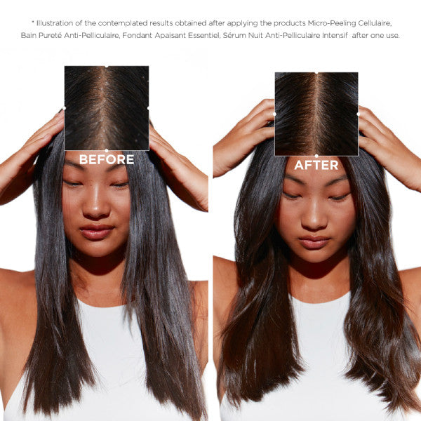 Kerastase Symbiose Cellulaire Nuit Anti-Dandruff Night Scalp Serum 90ml